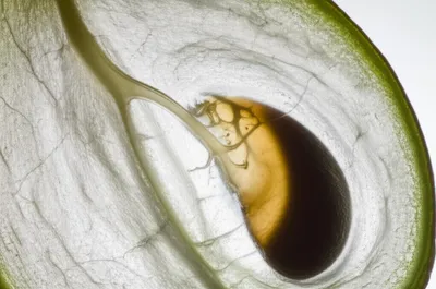 Illustration funiculus - Image 1