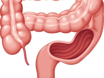 Illustration intestinal - Image 1