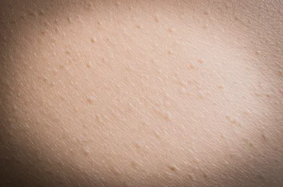 Illustration pits - Image 1