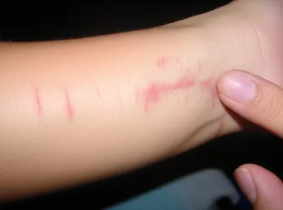 Illustration scratched - Image 1