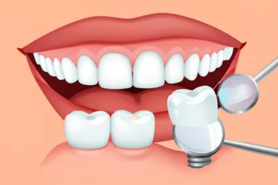 Illustration dentistry - Image 1