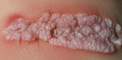 Illustration fungi - Image 1