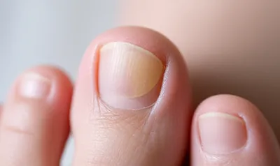 Illustration footpads - Image 1