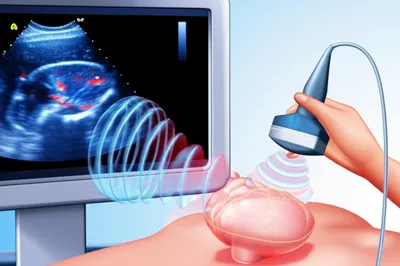 Illustration echo - Image 1