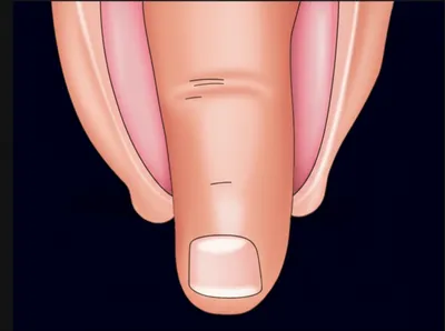 Illustration hilt - Image 1