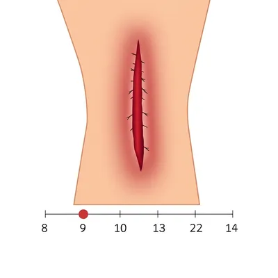 Illustration chronic - Image 1