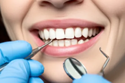 Illustration temporise - Image 1