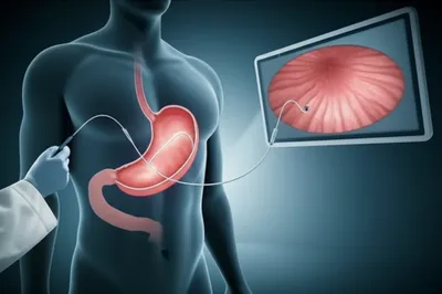 Illustration endoscopies - Image 1