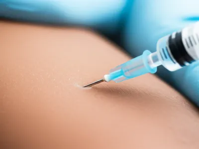 Illustration injected - Image 1