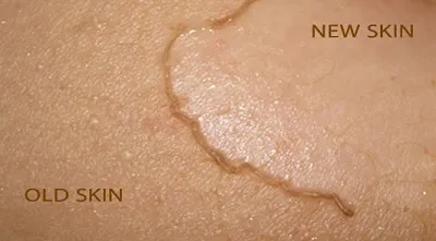 Illustration peel - Image 2