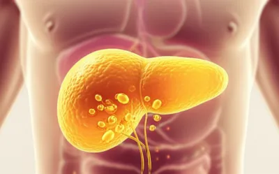 Illustration secretor - Image 1