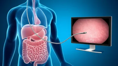 Illustration scoping - Image 1