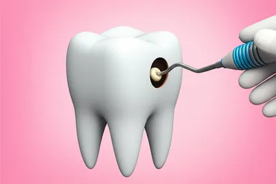 Illustration fill - Image 1