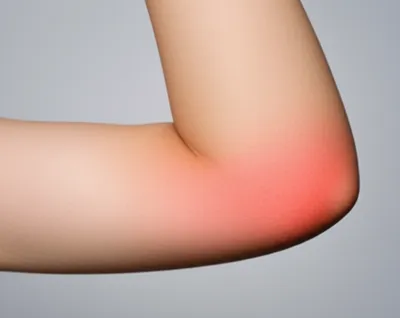 Illustration locally - Image 1