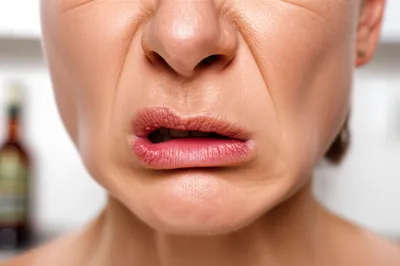 Illustration acetous - Image 1