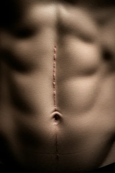 Illustration zippers - Image 1