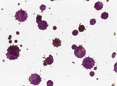 Illustration blotch - Image 1