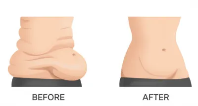 Illustration tucks - Image 1