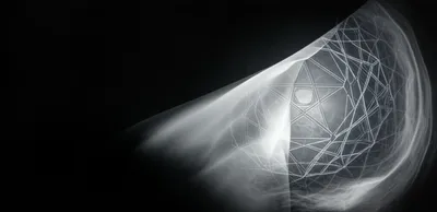 Illustration unfold - Image 1