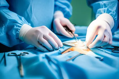 Illustration operating - Image 1