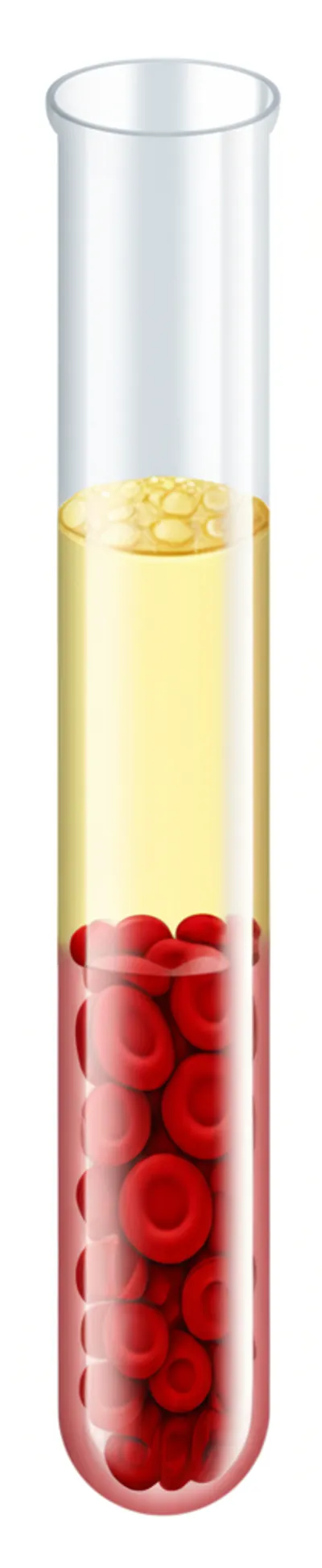 Hình ảnh minh họa hematocrit