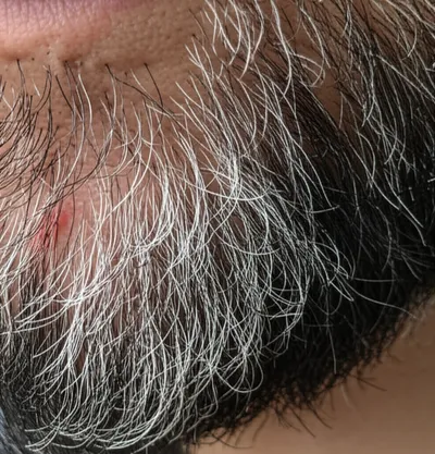 Illustration grizzled - Image 1