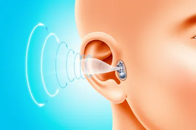 Illustration tympanic - Image 1