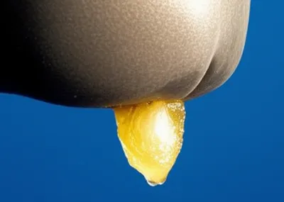 Illustration spermaceti