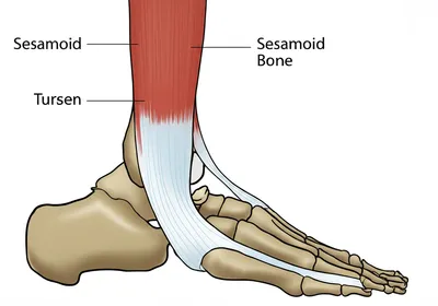 Illustration sesamoid