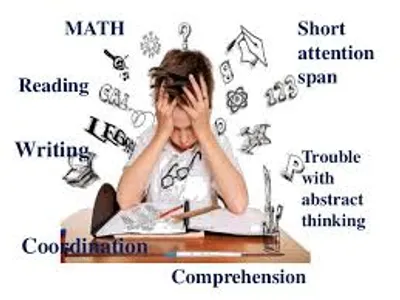 Illustration obtuse - Image 2