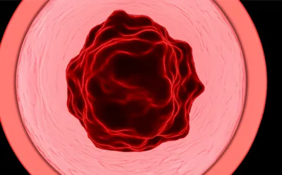 Illustration clots - Image 1