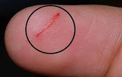 Illustration indolent - Image 2