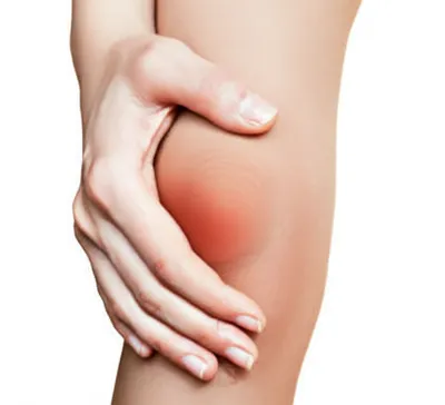 Illustration arthritis