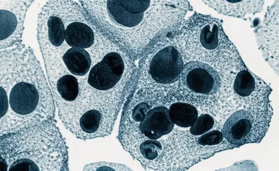 Illustration heterochromatic - Image 1