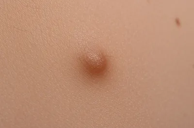 Illustration mole - Image 1