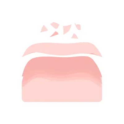 Illustration peel - Image 1