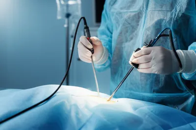 Illustration spear - Image 1