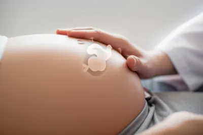 Illustration repercussion - Image 1