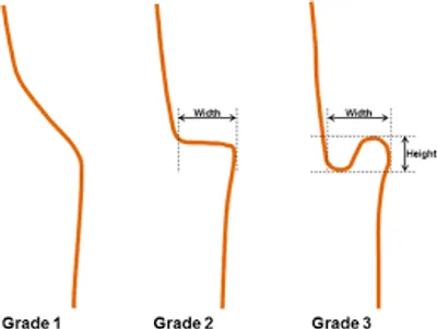 Illustration kink - Image 2