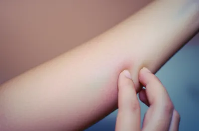 Illustration duller - Image 1