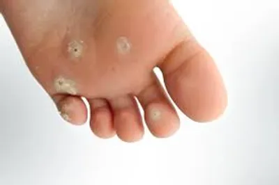 Illustration corn - Image 2