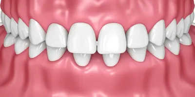 Illustration gums - Image 1