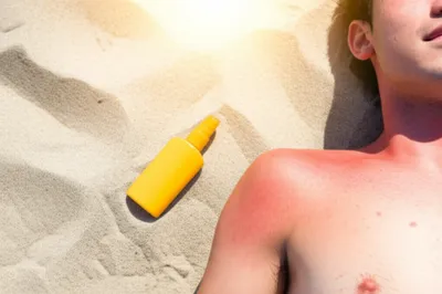 Illustration burn - Image 1