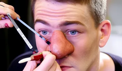 Illustration prosthetic - Image 1