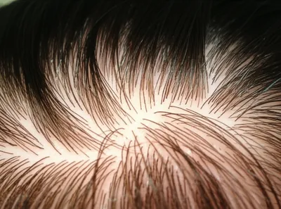 Illustration hair - Image 1