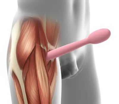 Illustration peg - Image 1