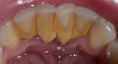 Illustration plaque - Image 3