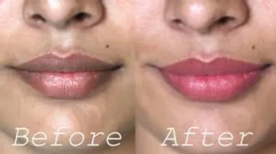 Illustration lighten - Image 2