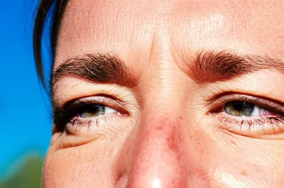 Illustration squint - Image 1