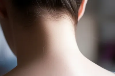 Illustration nape - Image 1